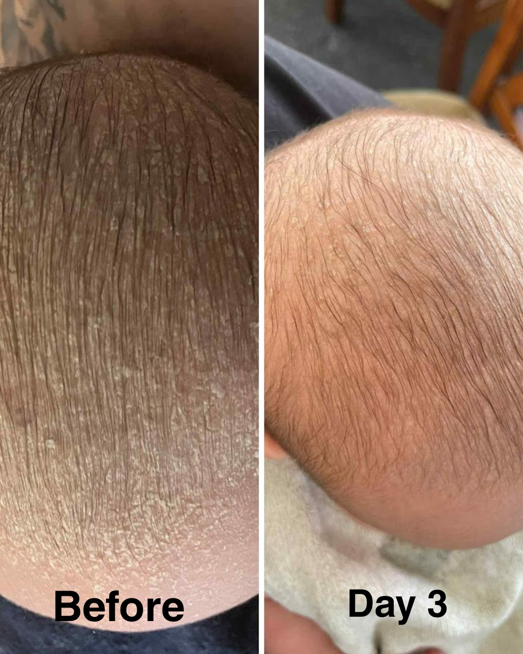 Grass-fed Beef Tallow Rescue Balm